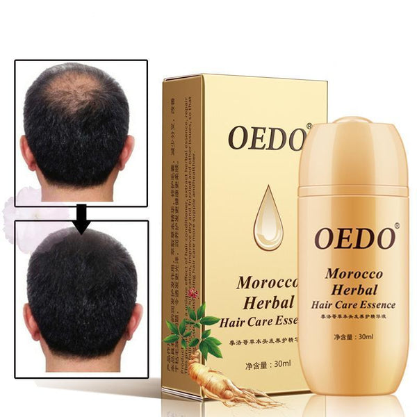 Herbal Hair Growth Treatment